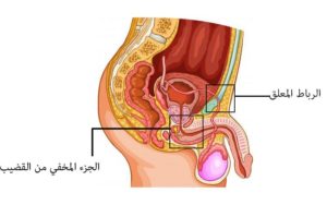 قطع الرباط في عمليات تكبير الذكر
